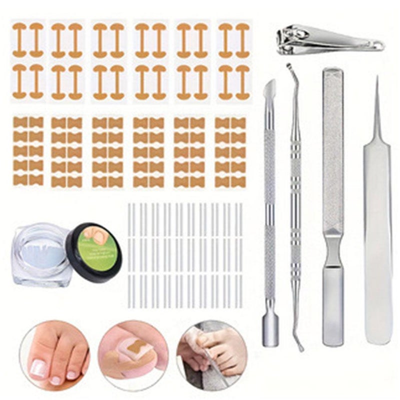 30 Filler Pads - Ingrown Toenail Corrector Tweezers Nail Remover Nail Groove Orthopedic Tape C-Shaped Socket Toe Inflammation Kit